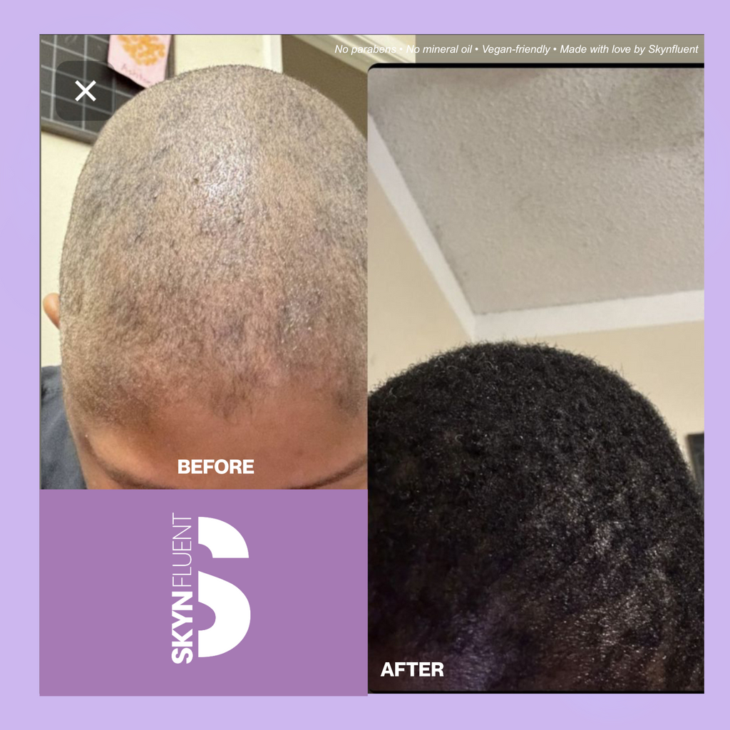 Chebe Repair Butter for High Porosity Hair – Repair Breakage & Soften